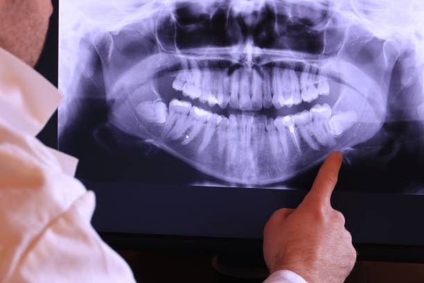Urgent Tooth Repair in MT